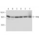 IKKβ Antibody (10A9B6) - Western Blotting - Image 17433