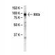 IKKβ Antibody (62AT216) - Western Blotting - Image 37652