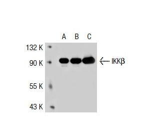 IKK&beta; Antibody (62AT216) - Western Blotting - Image 38581 