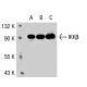 IKKβ Antibody (62AT216) - Western Blotting - Image 38581 