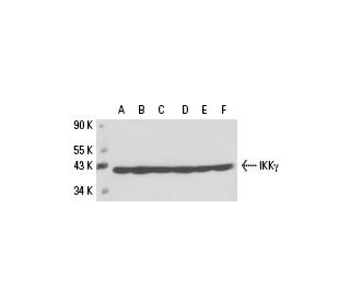 IKK&gamma; Antibody (1.T.26) - Western Blotting - Image 17503 