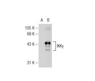 IKK&gamma; Antibody (46B844) - Western Blotting - Image 125888 