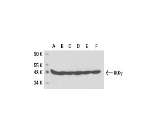 IKK&gamma; Antibody (72C627) - Western Blotting - Image 17502 