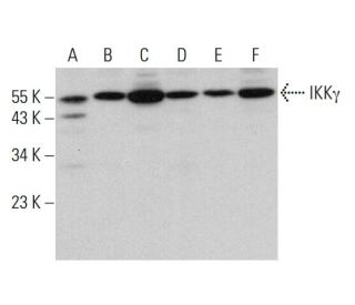 IKK&gamma; Antibody (B-3) - Western Blotting - Image 379862 