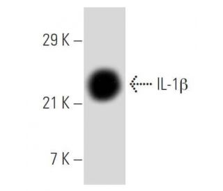 IL-1 beta/IL1B Antibody (E7-2-hIL1&beta;) - Western Blotting - Image 8894 