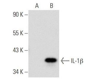 IL-1 beta/IL1B Antibody (E7-2-hIL1&beta;) - Western Blotting - Image 56608 