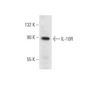 IL-10R Antibody (3F9) - Western Blotting - Image 56616