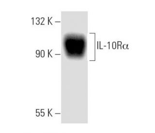 IL-10R&alpha; Antibody (E-6) - Western Blotting - Image 8919 