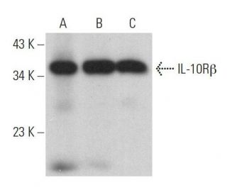 IL-10R&beta; Antibody (B-4) - Western Blotting - Image 359160 