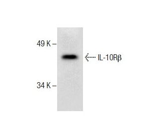 IL-10R&beta; Antibody (E-1) - Western Blotting - Image 287886 