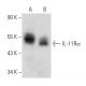 IL-11Rα Antibody (B-7) - Western Blotting - Image 357295 