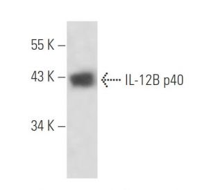 IL-12B p40 Antibody (1-1A4) - Western Blotting - Image 16291SAM Transcription Activation: SAM system utilizing dCas9-VP64, MS2-P65-HSF1, and sgRNA for precise gene transcription activation.