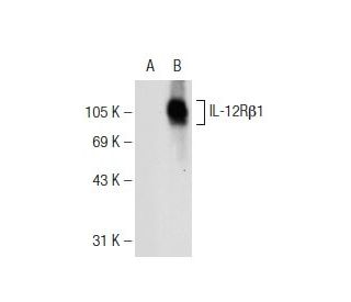 IL-12R&beta;1 Antibody (A-10) - Western Blotting - Image 109035 