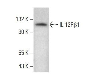 IL-12R&beta;1 Antibody (DU-1) - Western Blotting - Image 383306 