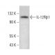 IL-12Rβ1 Antibody (DU-1) - Western Blotting - Image 383306 