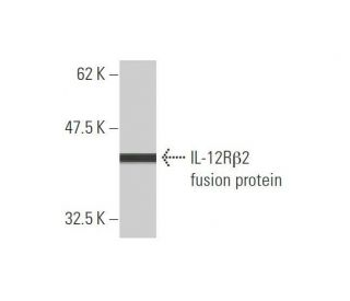 IL-12R&beta;2 Antibody (2H6) - Western Blotting - Image 348525