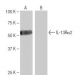 IL-13Rα2 Antibody (2K8) - Western Blotting - Image 64970