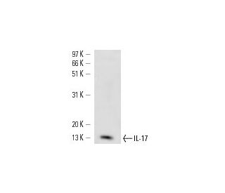 IL-17 Antibody (TC11-18H10) - Western Blotting - Image 14859Each CRISPR/Cas9 Knockout (KO) Plasmid product consists of a pool of 3 plasmids designed to ensure identification and cleavage of a specific gene for maximum knockout efficiency. Each plasmid encodes a unique 20 nt sequence derived from the GeCKO (v2) library.