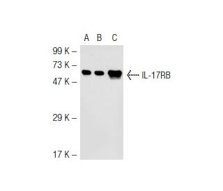 IL-17RB Antibody (TJ-5) - Western Blotting - Image 44507 