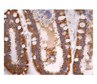 IL-1&alpha; Antibody (G-10) - Immunohistochemistry - Image 160269 