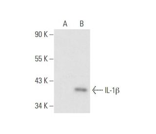 IL-1 beta/IL1B Antibody (11E5) - Western Blotting - Image 56596 