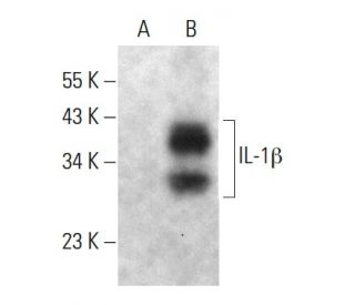 IL-1 beta/IL1B Antibody (E-12) - Western Blotting - Image 364822 