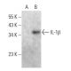 IL-1 beta/IL1B Antibody (E-12) - Western Blotting - Image 364823