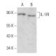 IL-1RI Antibody (H-8) - Western Blotting - Image 354309