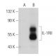 IL-1RII Antibody (6G5) - Western Blotting - Image 32641