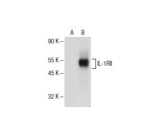 IL-1RII Antibody (G-5) - Western Blotting - Image 154663
