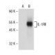 IL-1RII Antibody (G-5) - Western Blotting - Image 154663