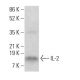IL-2 Antibody (B-10) - Western Blotting - Image 384704