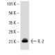 IL-2 Antibody (C2-1-hIL2) - Western Blotting - Image 8895