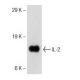 IL-2 Antibody (C2-1-hIL2) - Western Blotting - Image 145732 