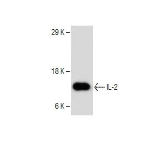 IL-2 Antibody (C2-1-hIL2) - Western Blotting - Image 150314