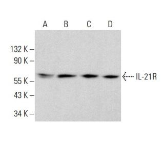 IL-21R Antibody (G-6) - Western Blotting - Image 383263 