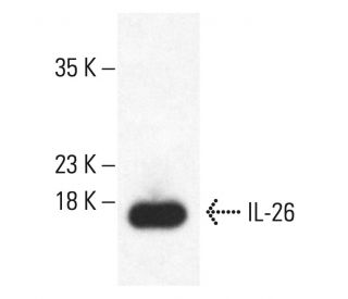 IL-26 Antibody (LL07) - Western Blotting - Image 401867