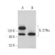 IL-27Rα Antibody (F-7) - Western Blotting - Image 365191 
