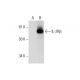 IL-2Rβ Antibody (C-10) - Western Blotting - Image 292065