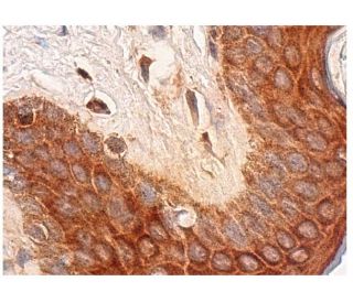 IL-2R&beta; Antibody (C-2) - Immunohistochemistry - Image 281920 