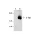 IL-2Rβ Antibody (C-2) - Western Blotting - Image 73164 