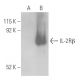 IL-2Rβ Antibody (C-2) - Western Blotting - Image 399060