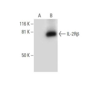 IL-2R&beta; Antibody (C-6) - Western Blotting - Image 294781