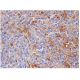 IL-2Rγ Antibody (A-10) - Immunohistochemistry - Image 284839 