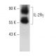 IL-2Rγ Antibody (A-10) - Western Blotting - Image 387348