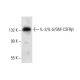 IL-3/IL-5/GM-CSFRβ Antibody (A-3) - Western Blotting - Image 303437 