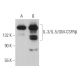IL-3/IL-5/GM-CSFRβ Antibody (A-3) - Western Blotting - Image 361877 