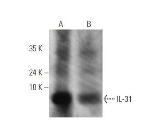 IL-31 Antibody (E-2) - Western Blotting - Image 346526