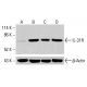RRS1 抗体 (H-5):sc-515462。Western blot 分析未处理的 HeLa(A)、经化学处理的 HeLa(B)、K-562(C)和 HCT-116(D)完整细胞裂解物中的 RRS1 表达。β-肌动蛋白 (C4): sc-47778 用作加载对照。使用的检测试剂:m-IgG Fc BP-HRP:sc-525409。 IL-31R Antibody (A-12) - Western Blotting - Image 416013