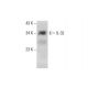 IL-32 Antibody (AT2F9) - Western Blotting - Image 384291